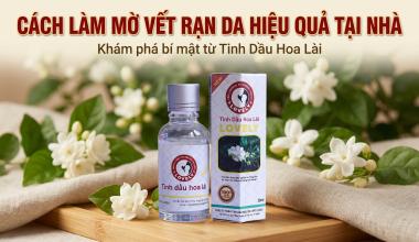 C&Aacute;CH L&Agrave;M MỜ VẾT RẠN DA HIỆU QUẢ TẠI NH&Agrave;